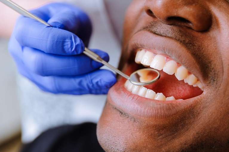 hand of dentist using a dental mirror to look at patient's gums