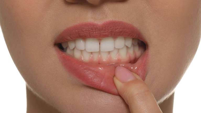 person showing healthy gums