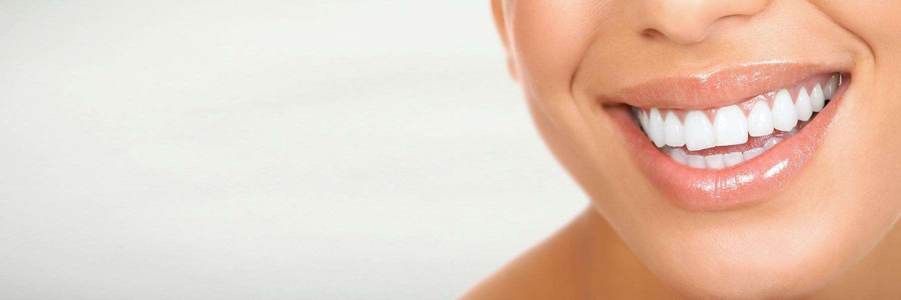 etobicoke woman smiling after getting veneers