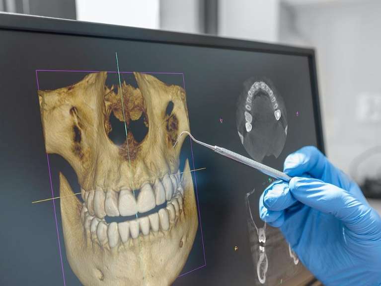 CT Scanner in Toronto Lakeshore Dental